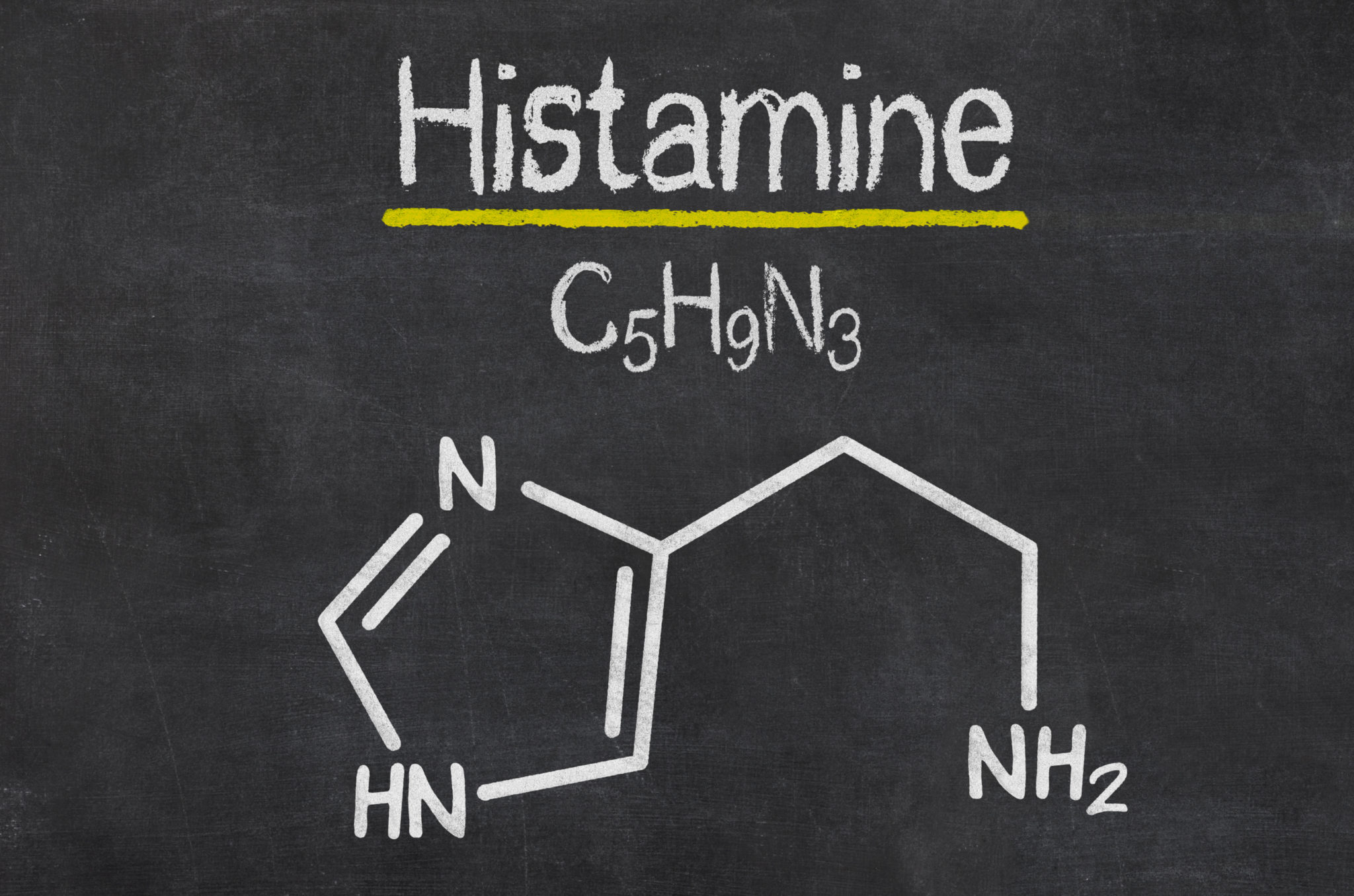 Histamine Intolerance Everything You Need to Know