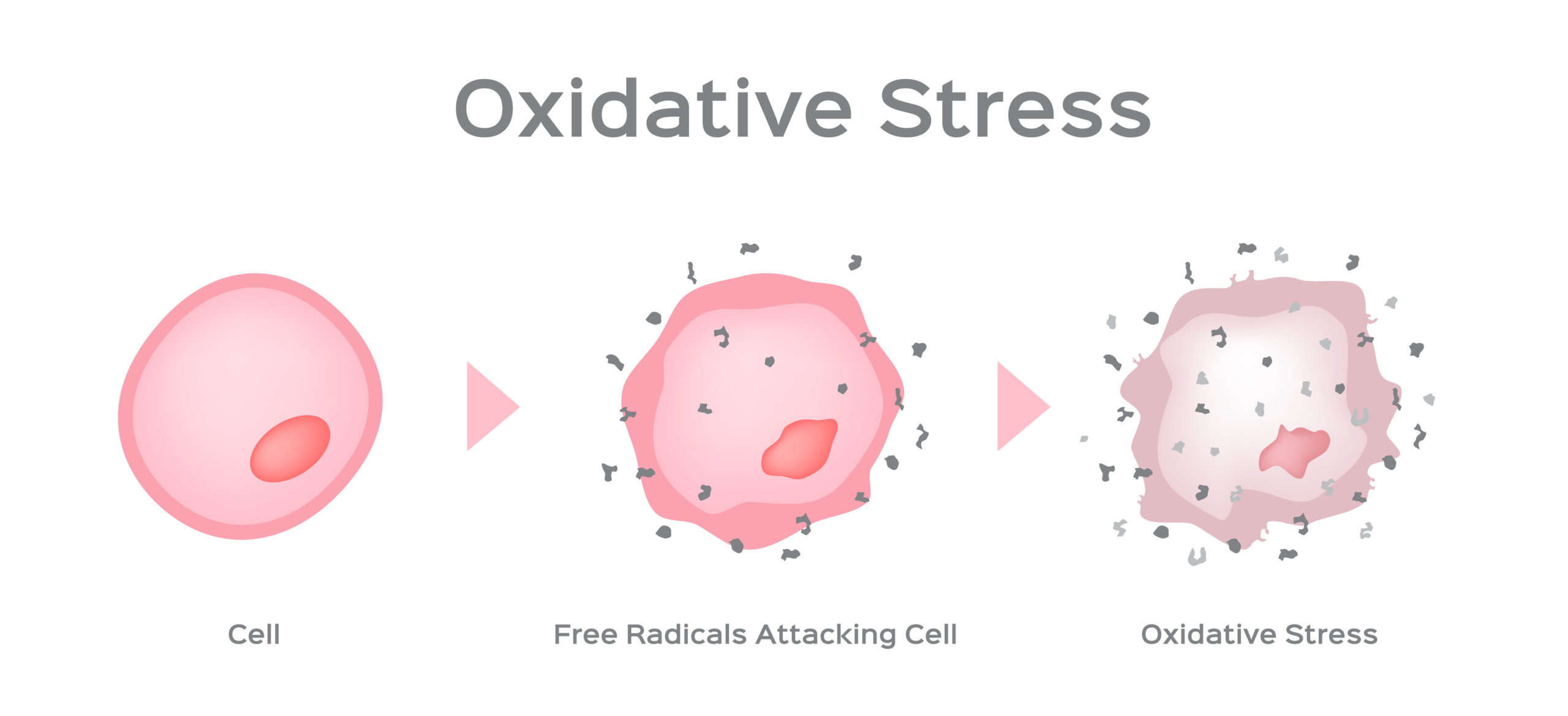 Oxidative Stress/Free Radical